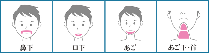 髭脱毛（鼻下・口下・あご・あご下）　６ヶ月間通い放題（１２回限度）