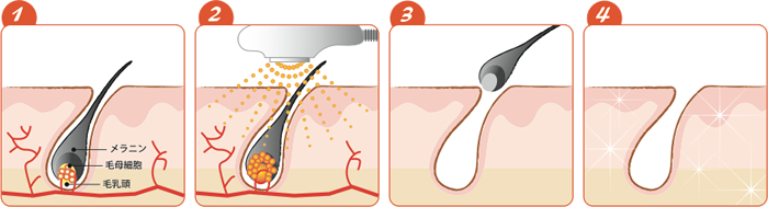 毛が抜ける仕組み